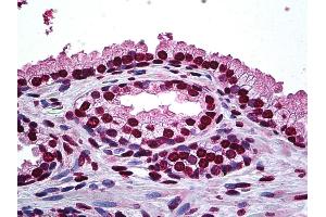 Anti-DLX2 antibody IHC of human prostate. (DLX2 antibody  (AA 1-110))