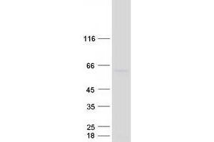 Western Blotting (WB) image for Centrosomal Protein 55kDa (CEP55) (Transcript Variant 1) protein (Myc-DYKDDDDK Tag) (ABIN2713918)