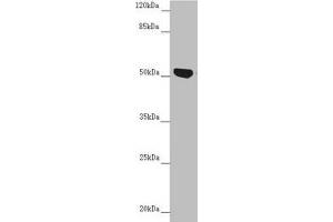Western blot All lanes: NUF2 antibody at 5. (NUF2 antibody  (AA 165-464))