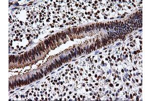 Image no. 9 for anti-EPM2A (Laforin) Interacting Protein 1 (EPM2AIP1) antibody (ABIN1498046) (EPM2AIP1 antibody)