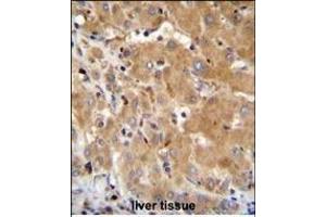 GGH Antibody (N-term) (ABIN655183 and ABIN2844798) immunohistochemistry analysis in formalin fixed and paraffin embedded human liver tissue followed by peroxidase conjugation of the secondary antibody and DAB staining.