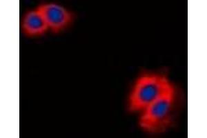 Immunofluorescent analysis of CARD11 staining in K562 cells. (CARD11 antibody  (N-Term))