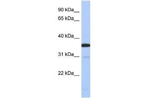 WB Suggested Anti-ESD Antibody Titration: 0. (Esterase D antibody  (N-Term))