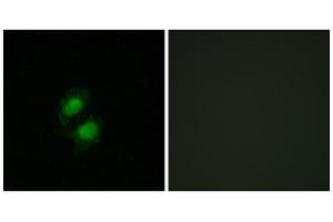 Immunofluorescence analysis of A549 cells, using ZNF95 antibody. (ZNF95 antibody  (Internal Region))