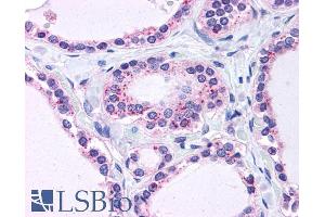 ABIN238580 (3. (RPL22 antibody  (C-Term))