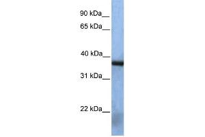 WB Suggested Anti-NAT12 Antibody Titration:  0. (NAA30 antibody  (Middle Region))