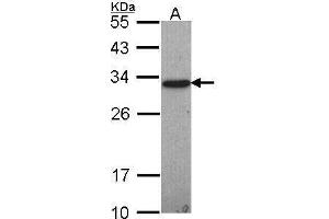 WB Image Sample (30 ug of whole cell lysate) A: Hep G2 , 12% SDS PAGE antibody diluted at 1:1000 (GSTO1 antibody)