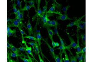 Immunofluorescent staining of C6 cells (right). (Clathrin antibody  (AA 4-171))