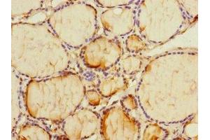 Immunohistochemistry of paraffin-embedded human thyroid tissue using ABIN7163386 at dilution of 1:100 (PMM2 antibody  (AA 1-246))