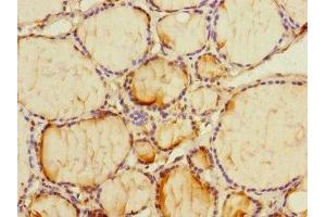 Immunohistochemistry of paraffin-embedded human thyroid tissue using ABIN7163386 at dilution of 1:100