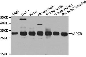 Western blot analysis of extract of various cells, using CAPZB antibody. (CAPZB antibody)