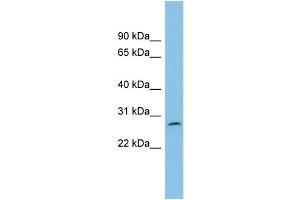 WB Suggested Anti-C1orf104 Antibody Titration: 0.