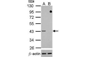 WB Image Western blot analysis of TDP-43 (, upper panel) and beta-actin , lower panel)  Sample (30 ug of whole cell lysate)   A: HeLa mock control  B: HeLa transfected shTDP-43 10% SDS PAGE  antibody diluted at 1:500 (TARDBP antibody)