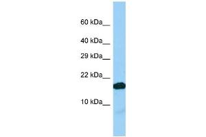 Host: Rabbit Target Name: IGFL2 Sample Type: Jurkat Whole Cell lysates Antibody Dilution: 1. (IGFL2 antibody  (C-Term))