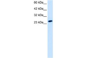 WB Suggested Anti-TBPL1 Antibody Titration:  1. (TBPL1 antibody  (Middle Region))
