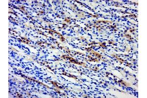 Paraformaldehyde-fixed, paraffin embedded rat kidney, Antigen retrieval by boiling in sodium citrate buffer (pH6) for 15min, Block endogenous peroxidase by 3% hydrogen peroxide for 30 minutes, Blocking buffer (normal goat serum) at 37°C for 20min, Antibody incubation with 	BPTF/FALZ Polyclonal Antibody, Unconjugated  at 1:500 overnight at 4°C, followed by a conjugated secondary and DAB staining. (BPTF antibody  (AA 2801-3046))