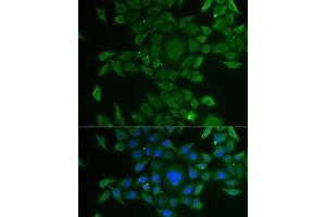 Immunofluorescence analysis of U2OS cells using CCBL1 Polyclonal Antibody (CCBL1 antibody)