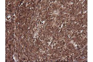 MAGEA4 antibody