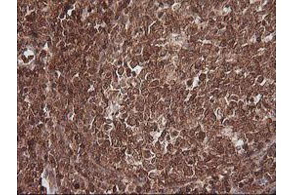 MAGEA4 antibody