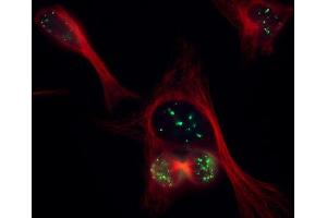 CENP-B antibody (pAb) tested by immunofluorescence. (CENPB antibody  (C-Term))