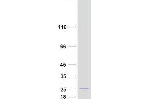 Validation with Western Blot