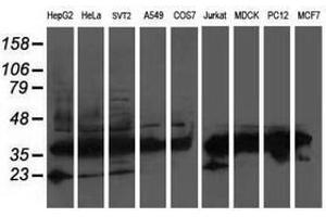Image no. 3 for anti-ATG3 Autophagy Related 3 (ATG3) antibody (ABIN1496762) (ATG3 antibody)