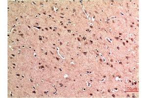 Immunohistochemical analysis of paraffin-embedded Human Brain Tissue using Beclin-1 Mouse mAb diluted at 1:200. (Beclin 1 antibody)