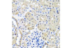 Immunohistochemistry of paraffin-embedded mouse kidney using BSND antibody. (BSND antibody)