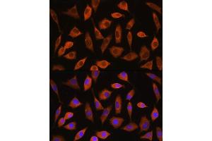 Immunofluorescence analysis of L929 cells using EIF2B4 Rabbit pAb (ABIN7267037) at dilution of 1:100. (EIF2B4 antibody)
