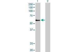 Western Blot analysis of FGFR1OP expression in transfected 293T cell line by FGFR1OP MaxPab polyclonal antibody. (FGFR1OP antibody  (AA 1-399))