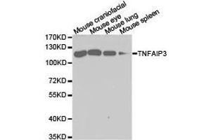 Western Blotting (WB) image for anti-Tumor Necrosis Factor, alpha-Induced Protein 3 (TNFAIP3) antibody (ABIN1875125) (TNFAIP3 antibody)