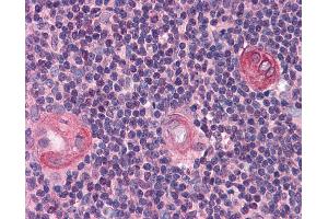 Immunohistochemistry (IHC) image for anti-B-Cell CLL/lymphoma 11B (Zinc Finger Protein) (BCL11B) (Middle Region) antibody (ABIN2777845) (BCL11B antibody  (Middle Region))