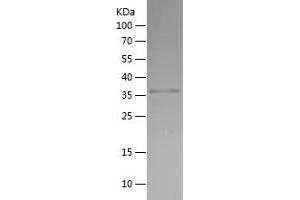 Doublecortin Protein (DCX) (AA 107-208) (His-IF2DI Tag)
