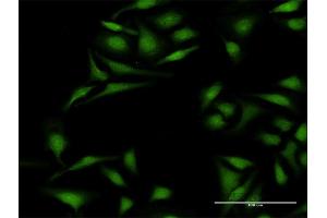 Immunofluorescence of purified MaxPab antibody to KRT12 on HeLa cell. (KRT12 antibody  (AA 1-494))