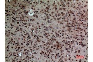 Immunohistochemistry (IHC) analysis of paraffin-embedded Mouse Brain, antibody was diluted at 1:100.