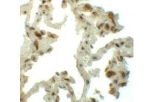 Immunohistochemistry (IHC) image for anti-Transmembrane 4 L Six Family Member 1 (TM4SF1) (N-Term) antibody (ABIN1031625) (TM4SF1 antibody  (N-Term))