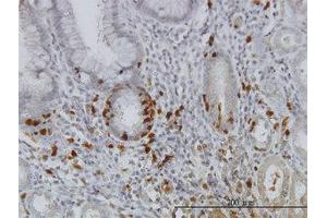 Image no. 1 for anti-Inhibitor of kappa Light Polypeptide Gene Enhancer in B-Cells, Kinase gamma (IKBKG) (AA 1-420) antibody (ABIN599042) (IKBKG antibody  (AA 1-420))