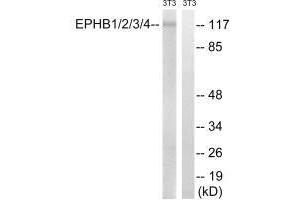 Western blot analysis of extracts from 3T3 cells, treated with heat shock, using EPHB1/2/3/4 (Ab-600/602/614/596) antibody. (Ephb1+Ephb2+Ephb3+Ephb4 (Tyr596), (Tyr600), (Tyr602), (Tyr614) antibody)