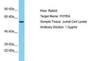 Host: Rabbit Target Name: POTEA Sample Tissue: Human Jurkat Whole Cell Antibody Dilution: 1ug/ml (POTEA antibody  (C-Term))