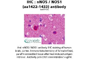 Image no. 1 for anti-Nitric Oxide Synthase 1, Neuronal (NOS1) (AA 1422-1433) antibody (ABIN5693644) (NOS1 antibody  (AA 1422-1433))