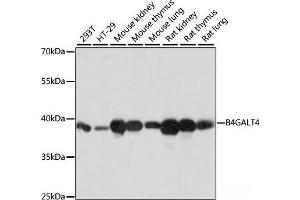 Western blot analysis of extracts of various cell lines using B4GALT4 Polyclonal Antibody at dilution of 1:1000. (B4GALT4 antibody)