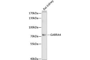 Western blot analysis of extracts of rat kidney, using G antibody (ABIN1679929, ABIN3018216, ABIN3018217 and ABIN6220403) at 1:1000 dilution.