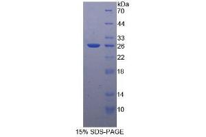SDS-PAGE (SDS) image for Angiopoietin 1 (ANGPT1) (AA 21-228) protein (His tag) (ABIN1877417)