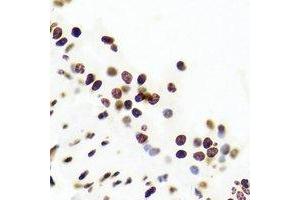 Immunohistochemistry (IHC) image for anti-Upstream Transcription Factor 1 (USF1) antibody (ABIN7308482) (USF1 antibody)