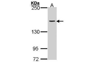 WB Image Sample (30 ug of whole cell lysate) A: H1299 5% SDS PAGE antibody diluted at 1:3000 (Topoisomerase II alpha antibody  (C-Term))