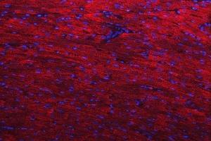 IF analysis of Desmin using anti-Desmin antibody (ABIN3043265).