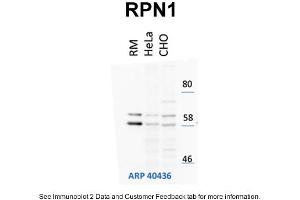 WB Suggested Anti-RPN1 Antibody Titration: 1 µg/mL Positive Control: HeLa and CHO-K1 cell lines, rouch canine microsomes (RPN1 antibody  (N-Term))
