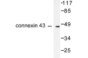 Image no. 1 for anti-Gap Junction Protein, alpha 1, 43kDa (GJA1) antibody (ABIN265368) (Connexin 43/GJA1 antibody)