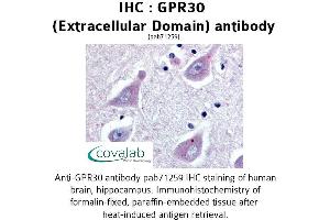 Image no. 1 for anti-G Protein-Coupled Estrogen Receptor 1 (GPER) (3rd Extracellular Domain) antibody (ABIN1735052) (GPER antibody  (3rd Extracellular Domain))