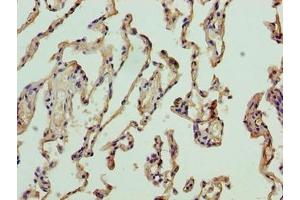 Immunohistochemistry of paraffin-embedded human lung tissue using ABIN7161563 at dilution of 1:100